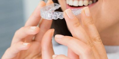 Invisalign - Usynlig tannregulering - 24 000 - 45 000